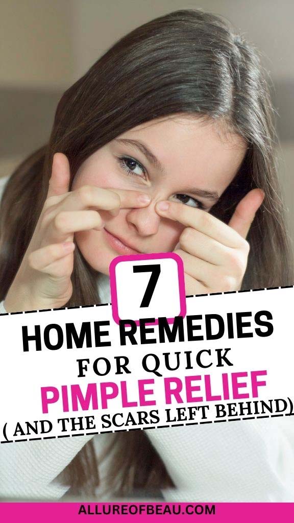 best way to get rid of pimple at home